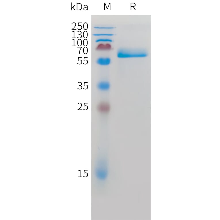 SDS-PAGE - Recombinant Human Intestinal Alkaline Phosphatase Protein (C-terminal 10xHis Tag) (A332885) - Antibodies.com