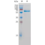 SDS-PAGE - Recombinant Human Intestinal Alkaline Phosphatase Protein (C-terminal 10xHis Tag) (A332885) - Antibodies.com