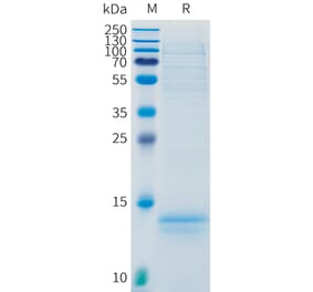 SDS-PAGE - Recombinant Human CD3 Protein (C-terminal 10xHis Tag) (A332888) - Antibodies.com