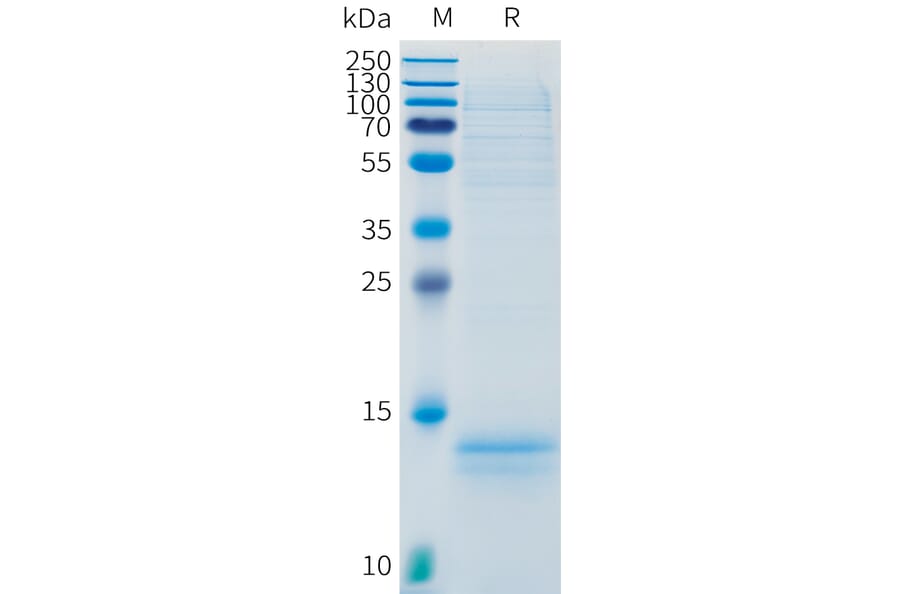 SDS-PAGE - Recombinant Human CD3 Protein (C-terminal 10xHis Tag) (A332888) - Antibodies.com