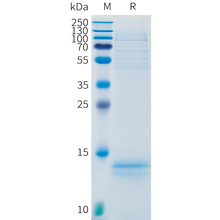 SDS-PAGE - Recombinant Human CD3 Protein (C-terminal 10xHis Tag) (A332888) - Antibodies.com
