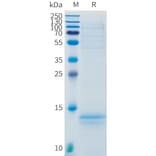 SDS-PAGE - Recombinant Human CD3 Protein (C-terminal 10xHis Tag) (A332888) - Antibodies.com