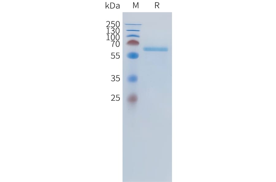 SDS-PAGE - Recombinant Human ALPL Protein (C-terminal 10xHis Tag) (A332889) - Antibodies.com
