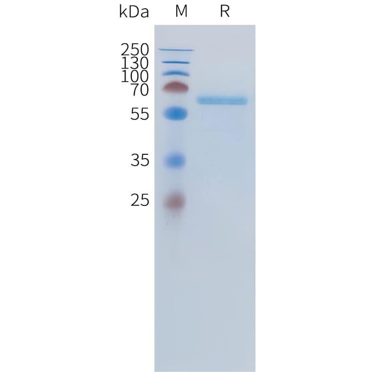 SDS-PAGE - Recombinant Human ALPL Protein (C-terminal 10xHis Tag) (A332889) - Antibodies.com
