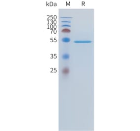 SDS-PAGE - Recombinant Human FGF19 Protein (C-terminal hFc Tag) (A332891) - Antibodies.com