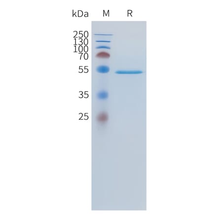 SDS-PAGE - Recombinant Human FGF19 Protein (C-terminal hFc Tag) (A332891) - Antibodies.com
