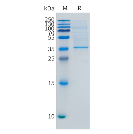 SDS-PAGE - Recombinant Human LY6E Protein (C-terminal hFc Tag) (A332892) - Antibodies.com
