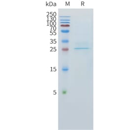 SDS-PAGE - Recombinant Human CLEC1 Protein (C-terminal 10xHis Tag) (A332893) - Antibodies.com