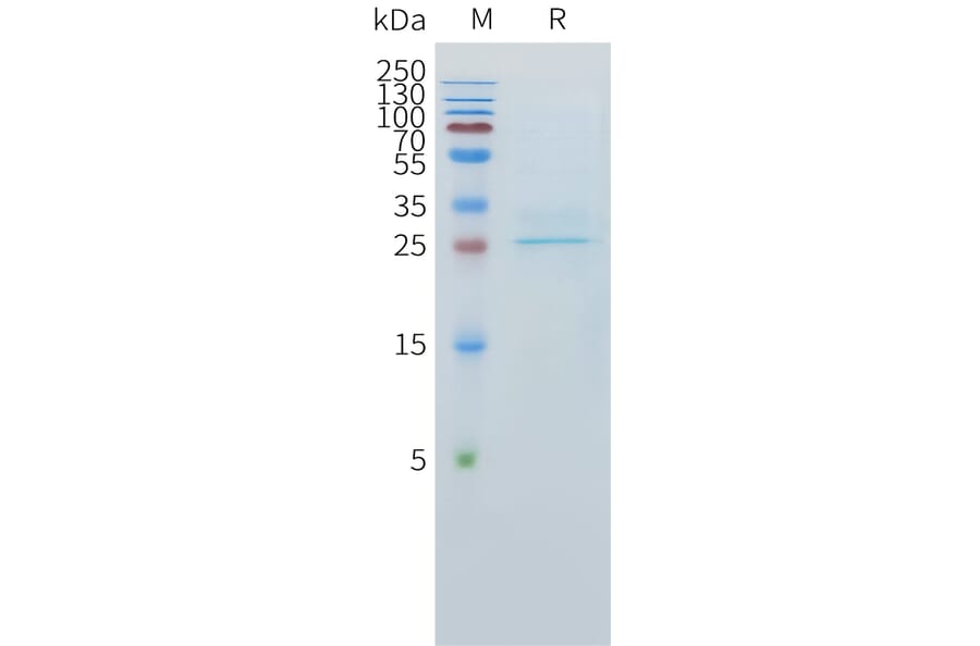 SDS-PAGE - Recombinant Human CLEC1 Protein (C-terminal 10xHis Tag) (A332893) - Antibodies.com