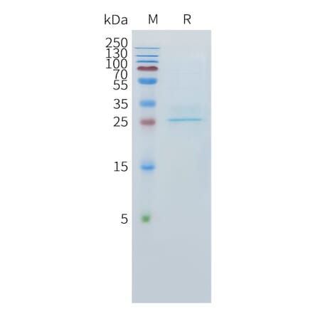 SDS-PAGE - Recombinant Human CLEC1 Protein (C-terminal 10xHis Tag) (A332893) - Antibodies.com
