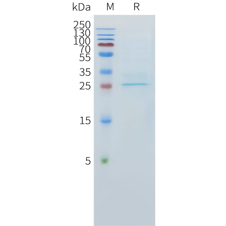 SDS-PAGE - Recombinant Human CLEC1 Protein (C-terminal 10xHis Tag) (A332893) - Antibodies.com