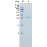 SDS-PAGE - Recombinant Human CLEC1 Protein (C-terminal 10xHis Tag) (A332893) - Antibodies.com