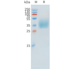 SDS-PAGE - Recombinant Human KIR2DL1 Protein (C-terminal 10xHis Tag) (A332894) - Antibodies.com
