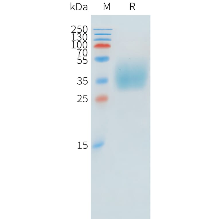 SDS-PAGE - Recombinant Human KIR2DL1 Protein (C-terminal 10xHis Tag) (A332894) - Antibodies.com