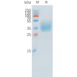 SDS-PAGE - Recombinant Human KIR2DL1 Protein (C-terminal 10xHis Tag) (A332894) - Antibodies.com