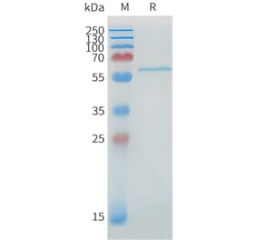 SDS-PAGE - Recombinant Human DLL1 Protein (C-terminal 6xHis Tag) (A332895) - Antibodies.com