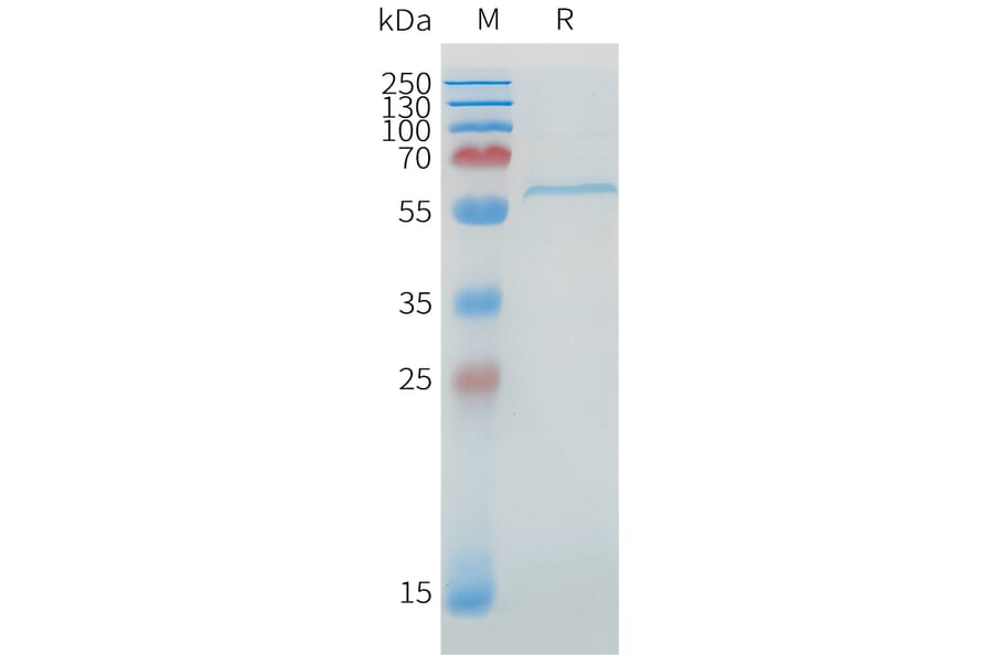 SDS-PAGE - Recombinant Human DLL1 Protein (C-terminal 6xHis Tag) (A332895) - Antibodies.com