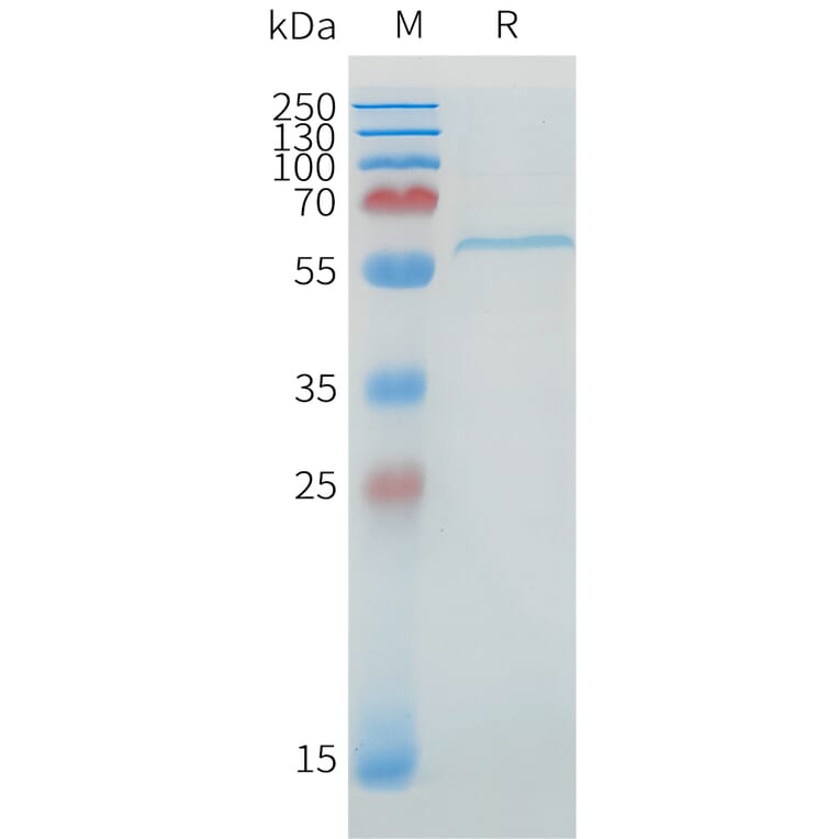 SDS-PAGE - Recombinant Human DLL1 Protein (C-terminal 6xHis Tag) (A332895) - Antibodies.com
