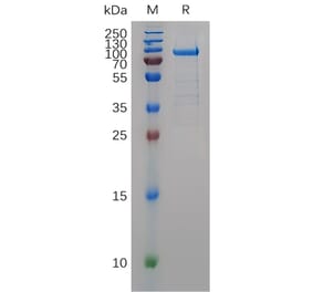 SDS-PAGE - Recombinant Human MMP9 Protein (C-terminal hFc Tag) (A332896) - Antibodies.com