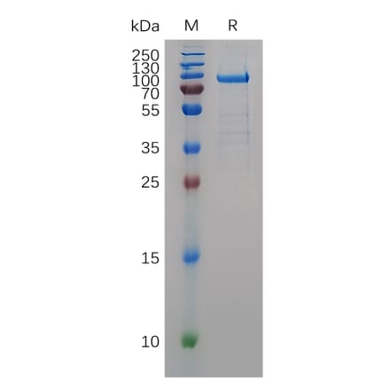 SDS-PAGE - Recombinant Human MMP9 Protein (C-terminal hFc Tag) (A332896) - Antibodies.com