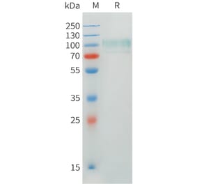 SDS-PAGE - Recombinant Human CADM1 Protein (C-terminal hFc Tag) (A332897) - Antibodies.com