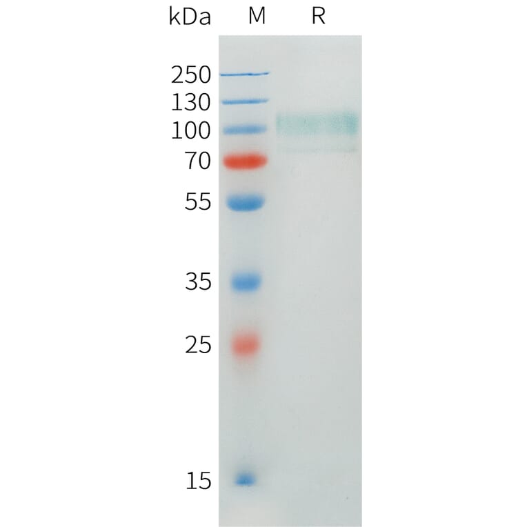 SDS-PAGE - Recombinant Human CADM1 Protein (C-terminal hFc Tag) (A332897) - Antibodies.com