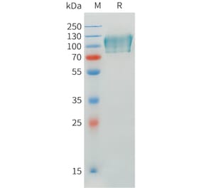SDS-PAGE - Recombinant Human CADM1 Protein (C-terminal mFc Tag) (A332898) - Antibodies.com