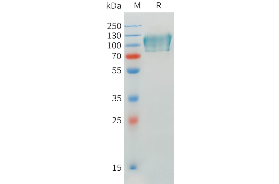SDS-PAGE - Recombinant Human CADM1 Protein (C-terminal mFc Tag) (A332898) - Antibodies.com
