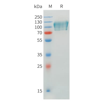 SDS-PAGE - Recombinant Human CADM1 Protein (C-terminal mFc Tag) (A332898) - Antibodies.com