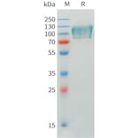 SDS-PAGE - Recombinant Human CADM1 Protein (C-terminal mFc Tag) (A332898) - Antibodies.com