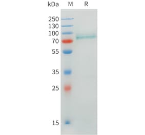 SDS-PAGE - Recombinant Human CRTAM Protein (C-terminal hFc Tag) (A332899) - Antibodies.com