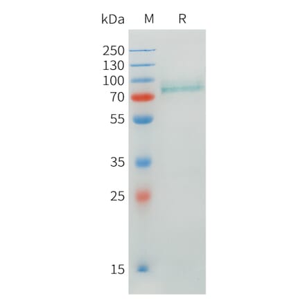 SDS-PAGE - Recombinant Human CRTAM Protein (C-terminal hFc Tag) (A332899) - Antibodies.com