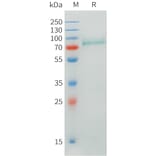 SDS-PAGE - Recombinant Human CRTAM Protein (C-terminal hFc Tag) (A332899) - Antibodies.com