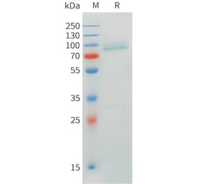 SDS-PAGE - Recombinant Human CRTAM Protein (C-terminal mFc Tag) (A332900) - Antibodies.com