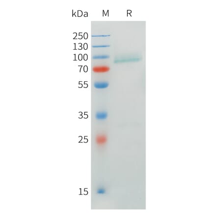 SDS-PAGE - Recombinant Human CRTAM Protein (C-terminal mFc Tag) (A332900) - Antibodies.com