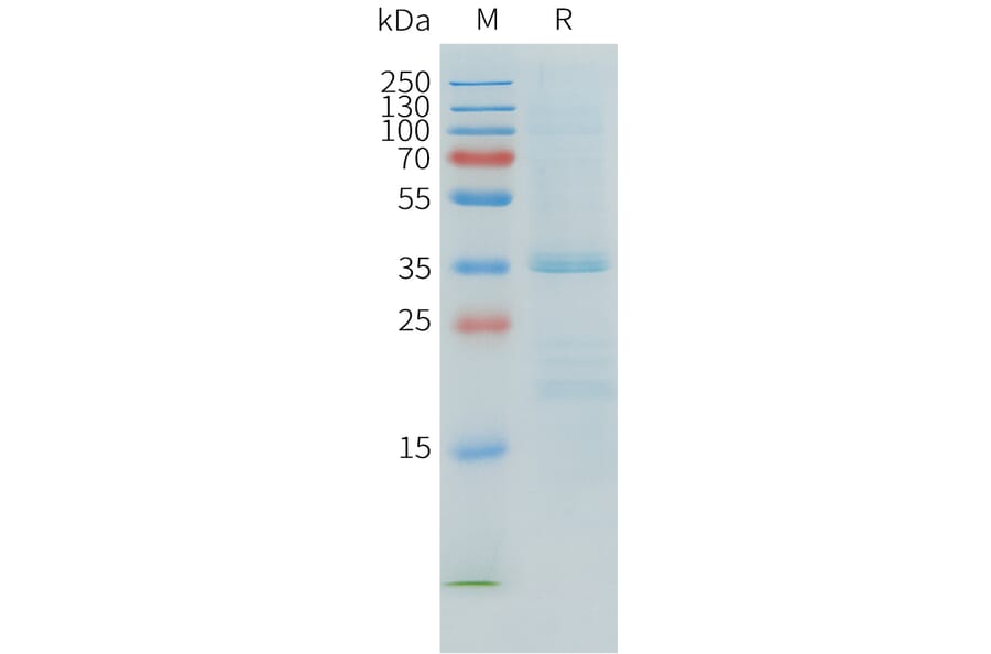 SDS-PAGE - Recombinant Human APOE Protein (C-terminal 6xHis Tag) (A332901) - Antibodies.com