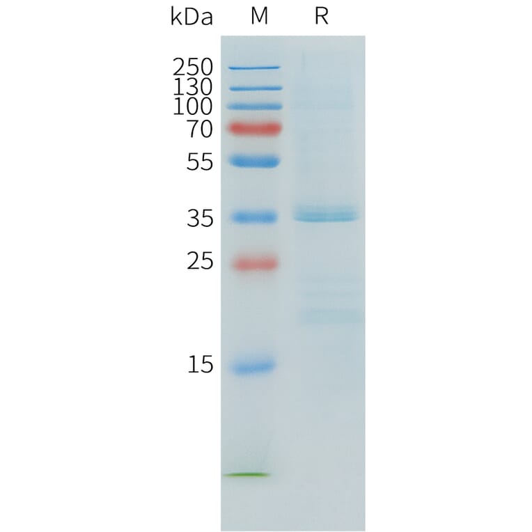 SDS-PAGE - Recombinant Human APOE Protein (C-terminal 6xHis Tag) (A332901) - Antibodies.com