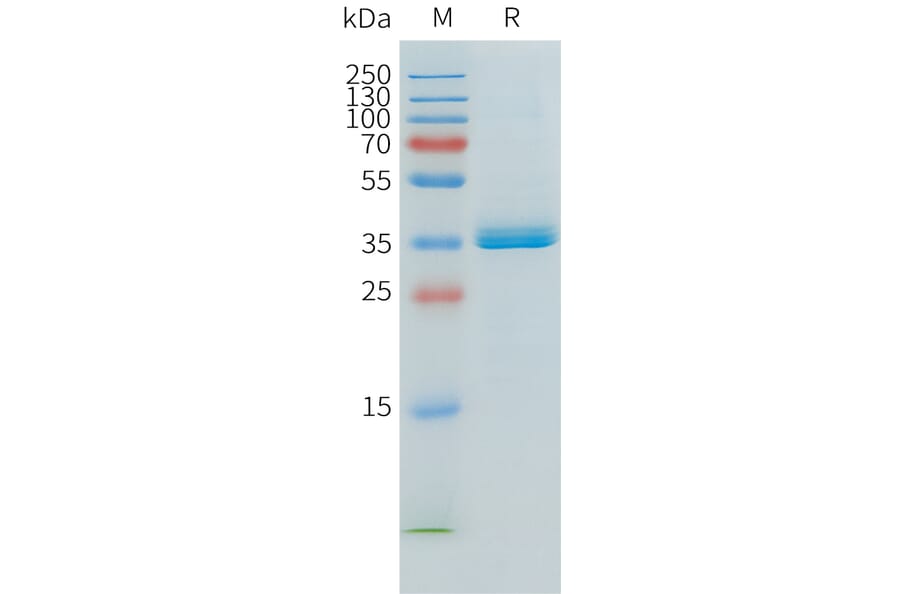 SDS-PAGE - Recombinant Human APOE Protein (C-terminal 6xHis Tag) (A332902) - Antibodies.com