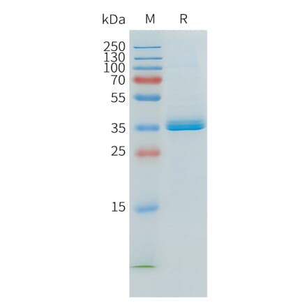 SDS-PAGE - Recombinant Human APOE Protein (C-terminal 6xHis Tag) (A332902) - Antibodies.com