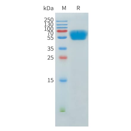 SDS-PAGE - Recombinant Human ACVR2A Protein (C-terminal hFc Tag) (A332903) - Antibodies.com