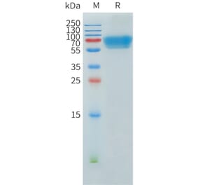 SDS-PAGE - Recombinant Human ACVR2B Protein (C-terminal hFc Tag) (A332904) - Antibodies.com