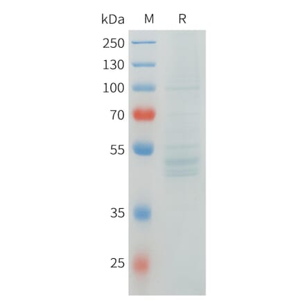 SDS-PAGE - Recombinant Human RNF133 Protein (C-terminal hFc Tag) (A332905) - Antibodies.com