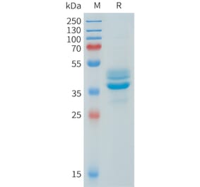 SDS-PAGE - Recombinant Human AKT1 Protein (N-terminal hFc Tag) (A332906) - Antibodies.com