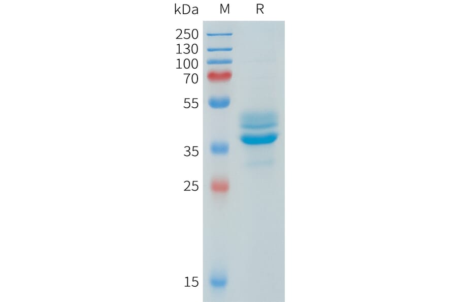 SDS-PAGE - Recombinant Human AKT1 Protein (N-terminal hFc Tag) (A332906) - Antibodies.com