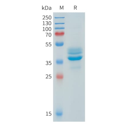 SDS-PAGE - Recombinant Human AKT1 Protein (N-terminal hFc Tag) (A332906) - Antibodies.com