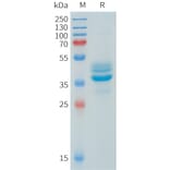 SDS-PAGE - Recombinant Human AKT1 Protein (N-terminal hFc Tag) (A332906) - Antibodies.com