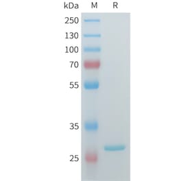 SDS-PAGE - Recombinant Human ERAB Protein (C-terminal 3xFlag Tag) (A332907) - Antibodies.com