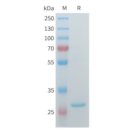 SDS-PAGE - Recombinant Human ERAB Protein (C-terminal 3xFlag Tag) (A332907) - Antibodies.com