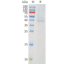 SDS-PAGE - Recombinant Human PVRIG Protein (C-terminal hFc Tag) (A332908) - Antibodies.com