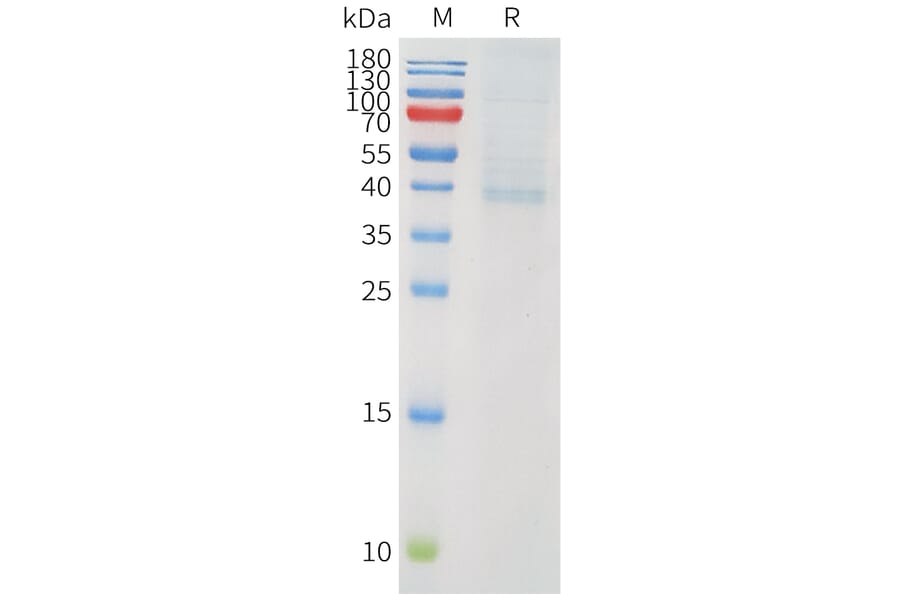 SDS-PAGE - Recombinant Human PVRIG Protein (C-terminal hFc Tag) (A332908) - Antibodies.com
